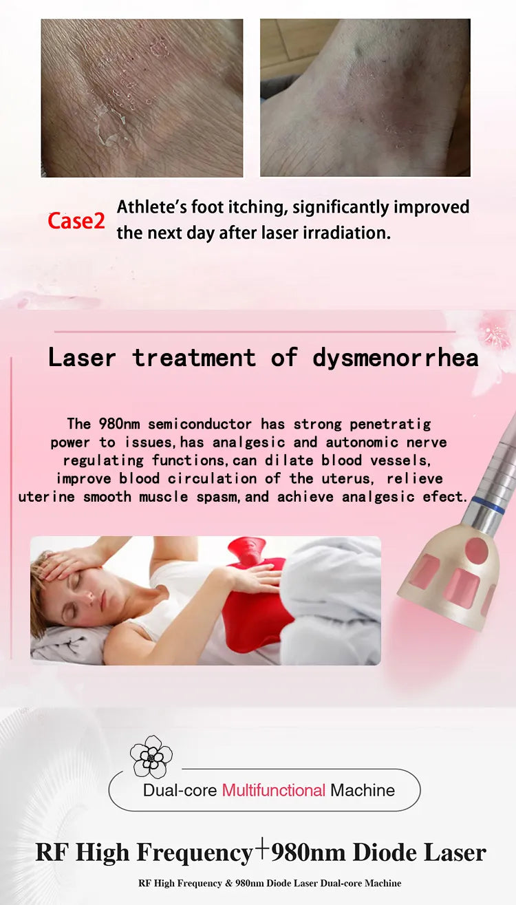 980Nm Laser Diode Vascular Spider Varicose Vein Removal Machine Treatment Fungi Physiotherapy