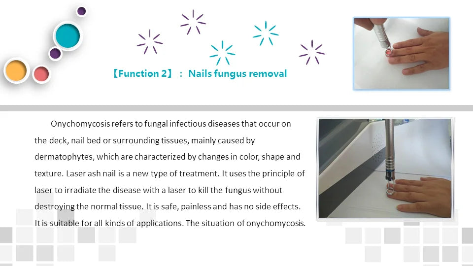 980Nm Laser Diode Vascular Spider Varicose Vein Removal Machine Treatment Fungi Physiotherapy For Nail Lipolisi Commercial Salon