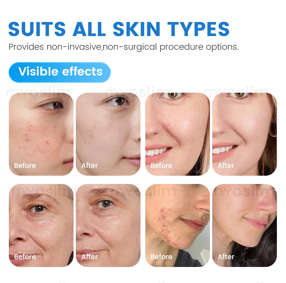 New Arrival 7 in 1 Hydro Dermabrasion Hydra Machine for Facial Aqua Peel Microdermabrasion Machine Skin Rejuvenation