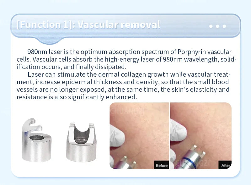 Diode Blood Vessels Removal Nail Fungus BEST 60W 980nm  Vascular Removal Machine Remove Spider Veins